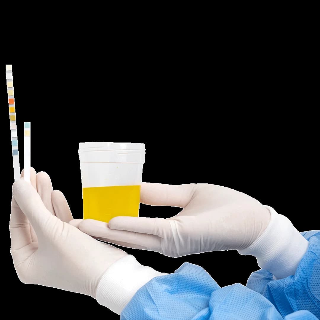 Urine Analysis