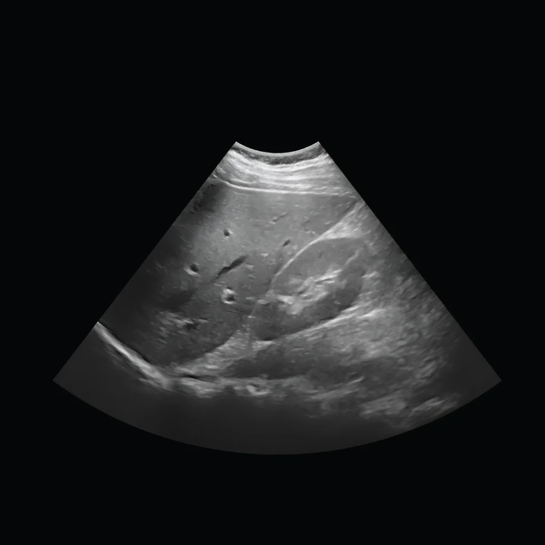Short Ultrasound Scan