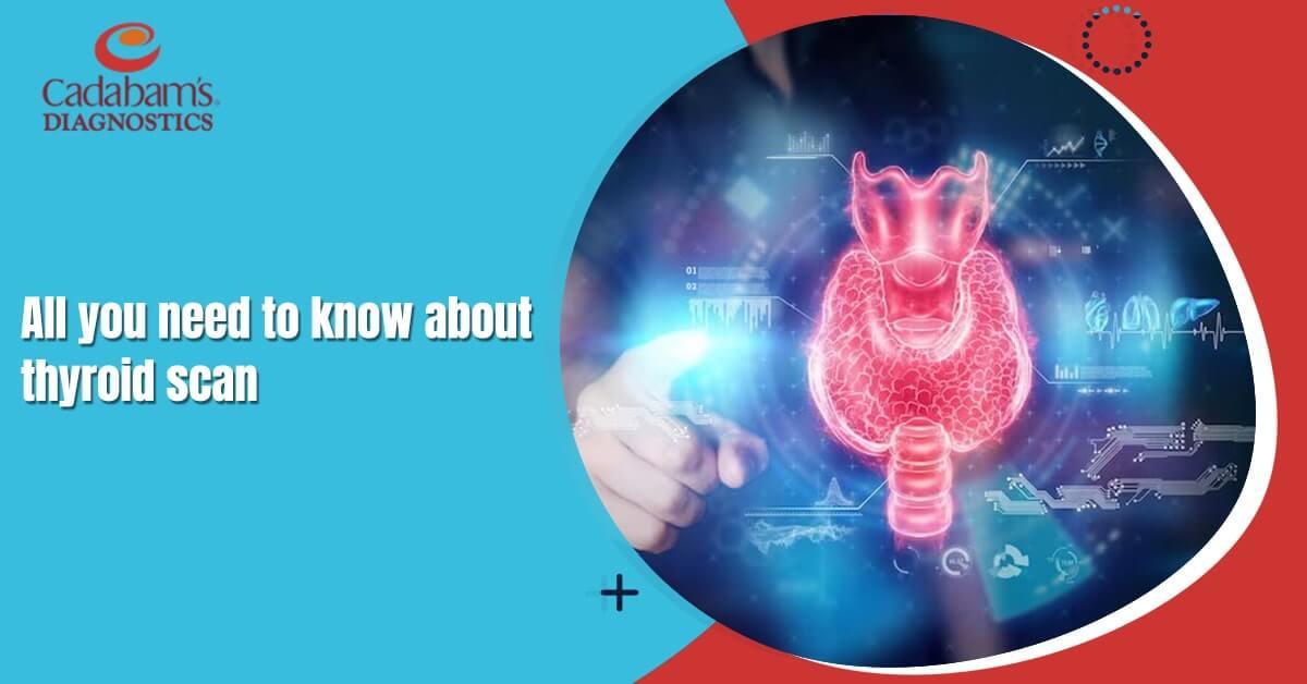 Everything You Need to Know About Thyroid Scans: Steps and Interpretations