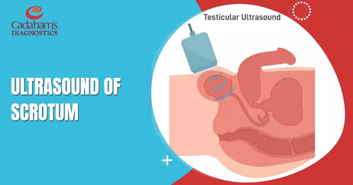 Scrotum Ultrasound: Diagnostic Uses and Procedure