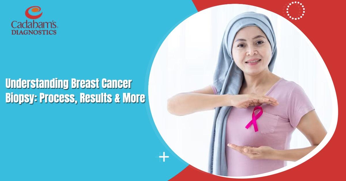 A Guide to Breast Cancer Biopsy and Its Results