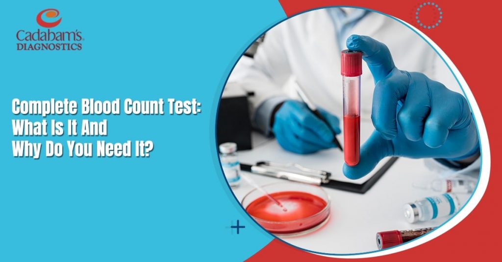 Complete Blood Count Test What Is It And Why Do You Need It
