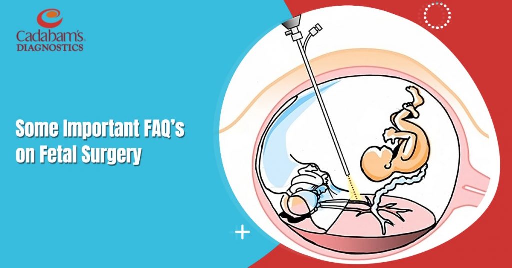 Some Important FAQ’s on Fetal Surgery