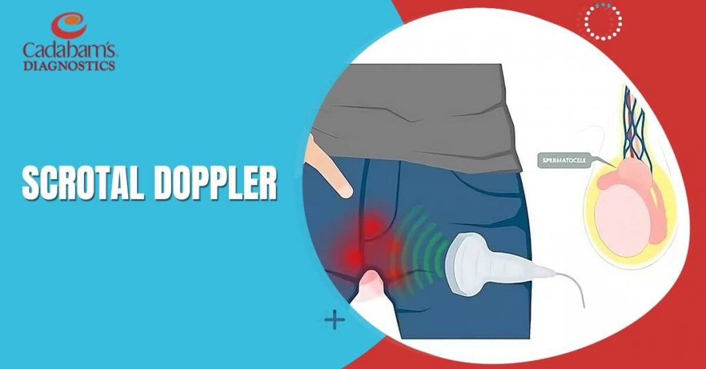 How Scrotal Doppler Ultrasound Works and its Applications