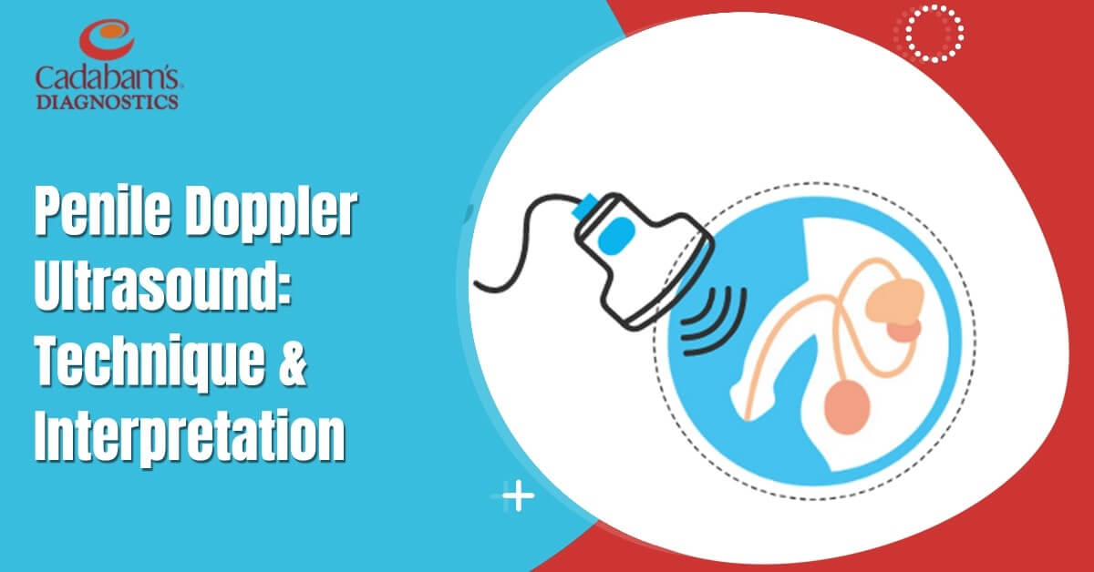 Penile Doppler Ultrasound Technique and Interpretation