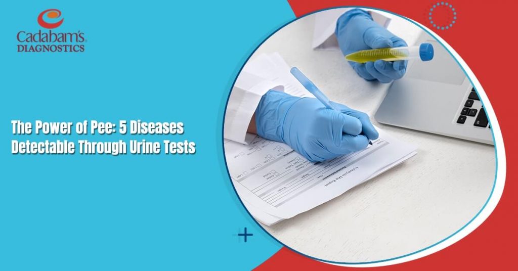 The Power of Pee 5 Diseases Detectable Through Urine Tests