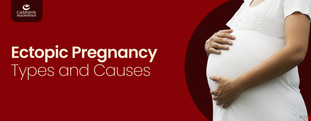 Ectopic Pregnancy: Causes and Types