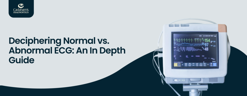 Understanding Normal ECG vs Abnormal ECG